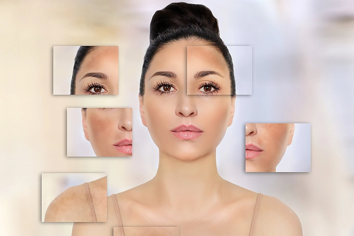 5 Best Ways to Treat and Prevent Hyperpigmentation