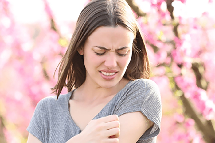Dealing With Allergies in Spring