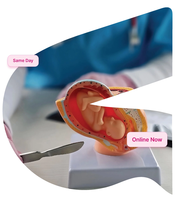 Pregnancy termination Mobile