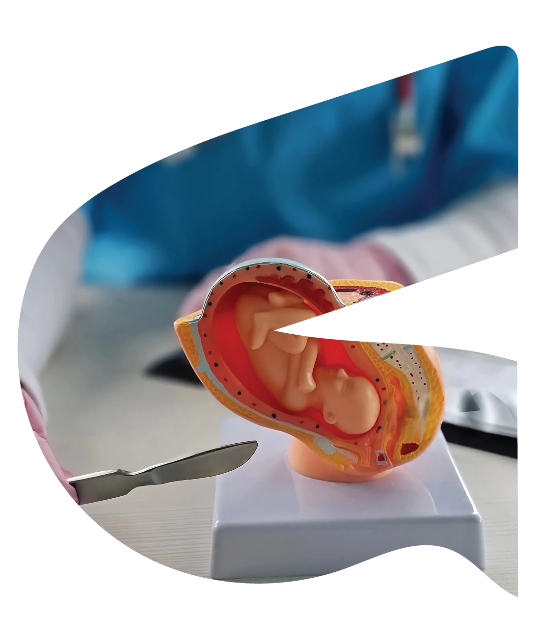 Pregnancy termination