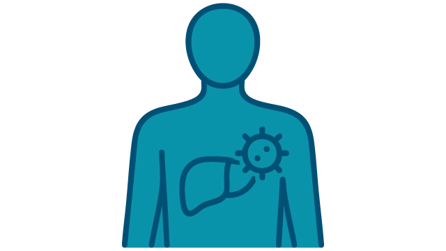 Endometriosis