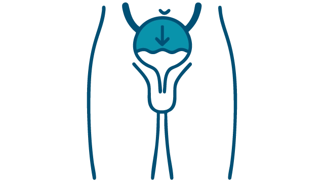 Urinary Incontinence