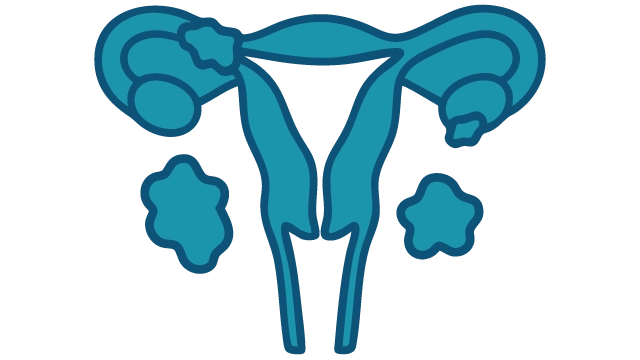 Endometriosis
