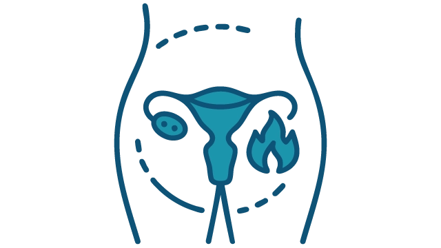 Endometriosis