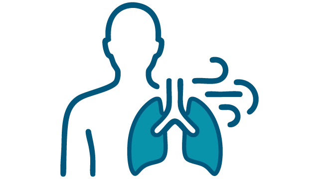 Chronic obstructive pulmonary disease image