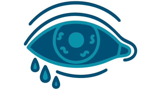 Conjunctivitis image